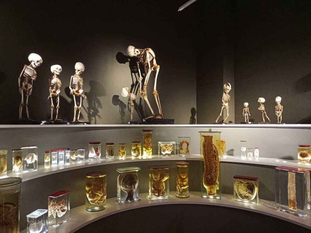 Er zijn die etages. Boven staan skeletten tentoongesteld. Op de middelste en onderste staan preparaten op sterk water, o.a. aan embryo's, een doorsnede van de rug, hersenen en zintuigen zoals oren en ogen.